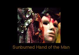 SUNBURNED HAND